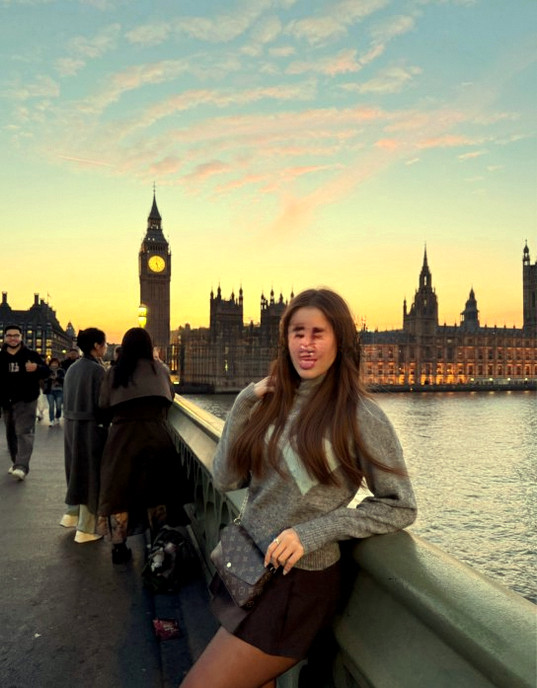 Chloe Amelie